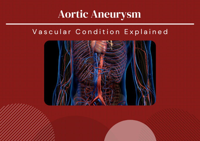 Aortic Aneurysm video thumbnail explaining condition
